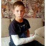 Мальчика, покалечившегося на детской площадке в Бердске, не оперируют