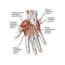 Для профилактики ризартроза необходимо снизить нагрузку на запястно-пястный сустав I-го пальца