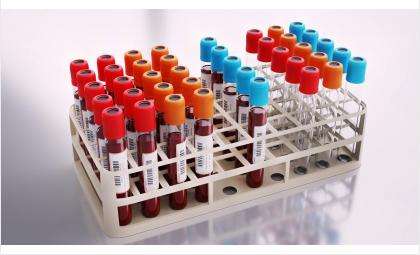 krov можно ли сделать медотвод при наличии антител