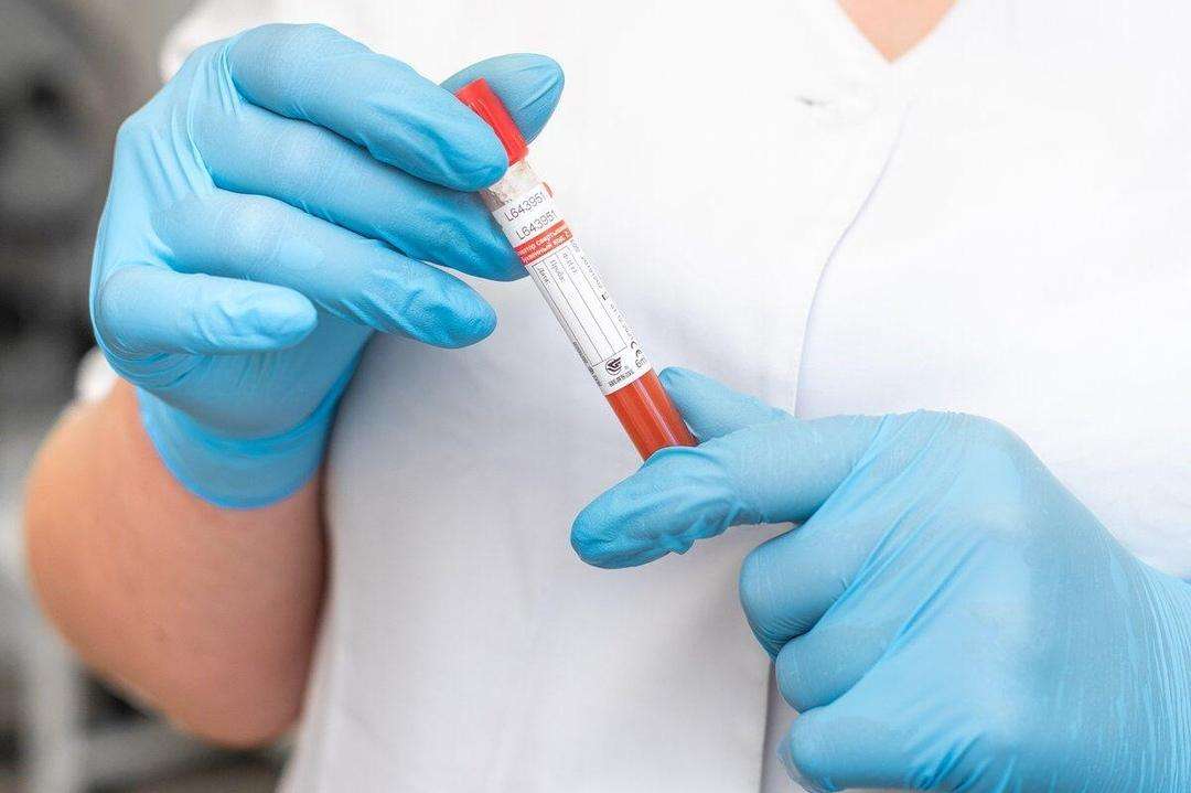 Где сдать кровь на антитела к COVID-19 в Бердске? Актуальный список медцентров