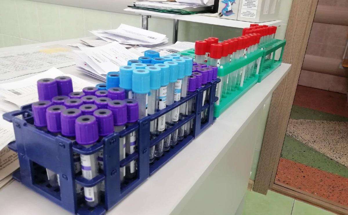 Антирекорд: 20 новых случаев коронавируса выявлено в Бердске за сутки