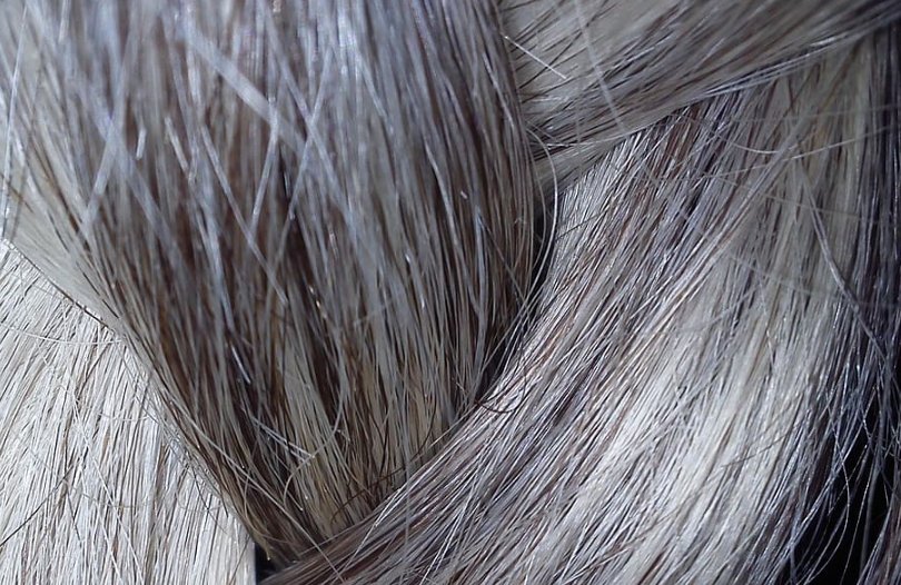 Седые волосы - результат нехватки меланина