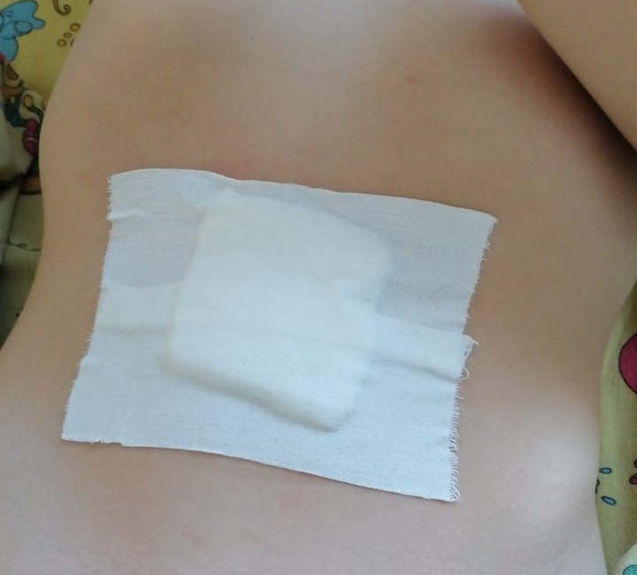 Ребенка прооперировали