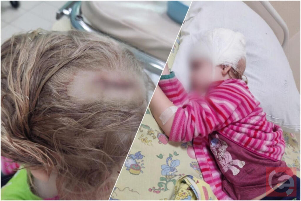 Пострадавший ребенок